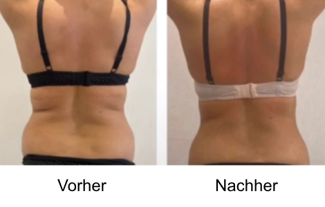 Before After Pictures