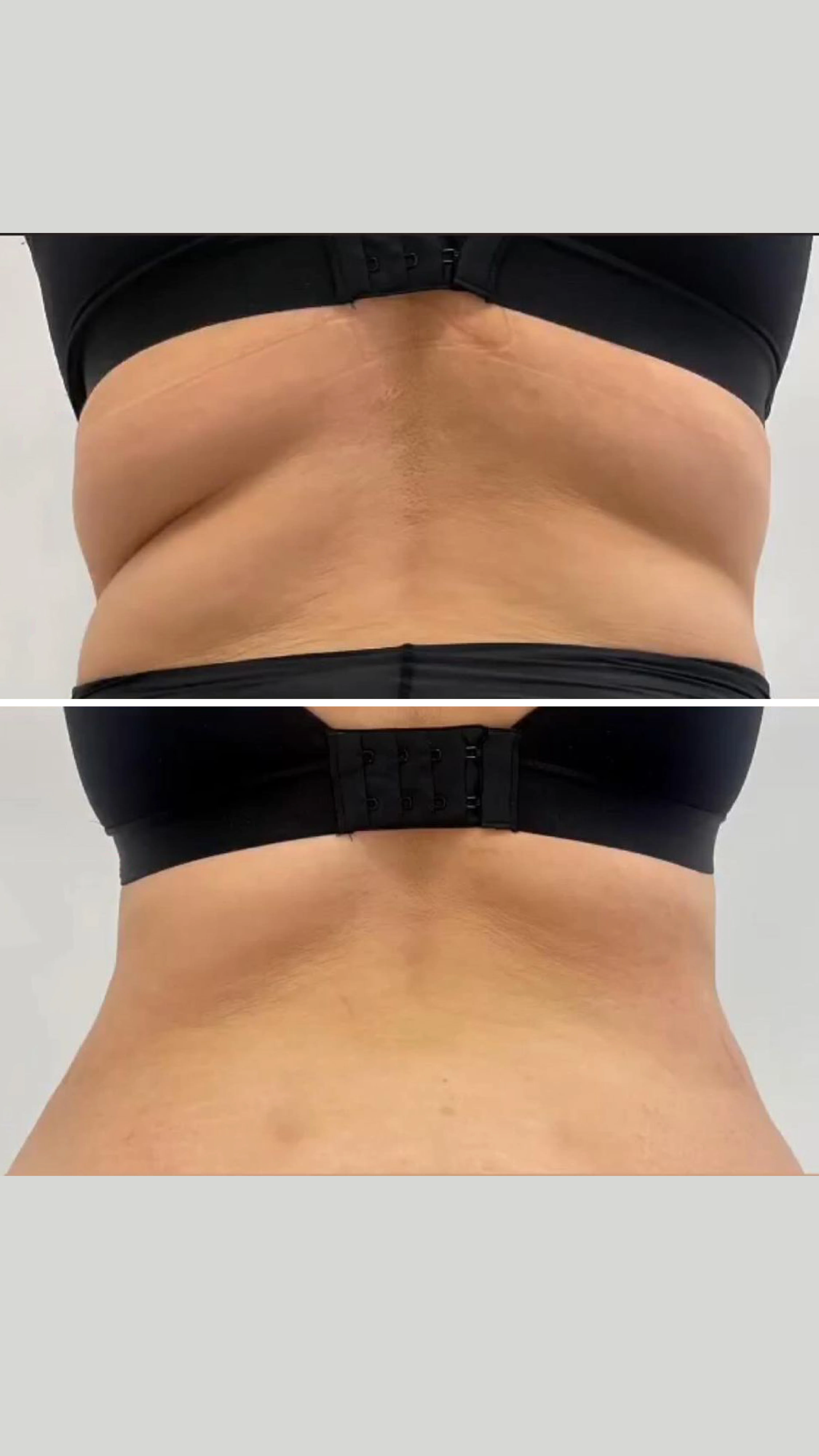 Before After Pictures