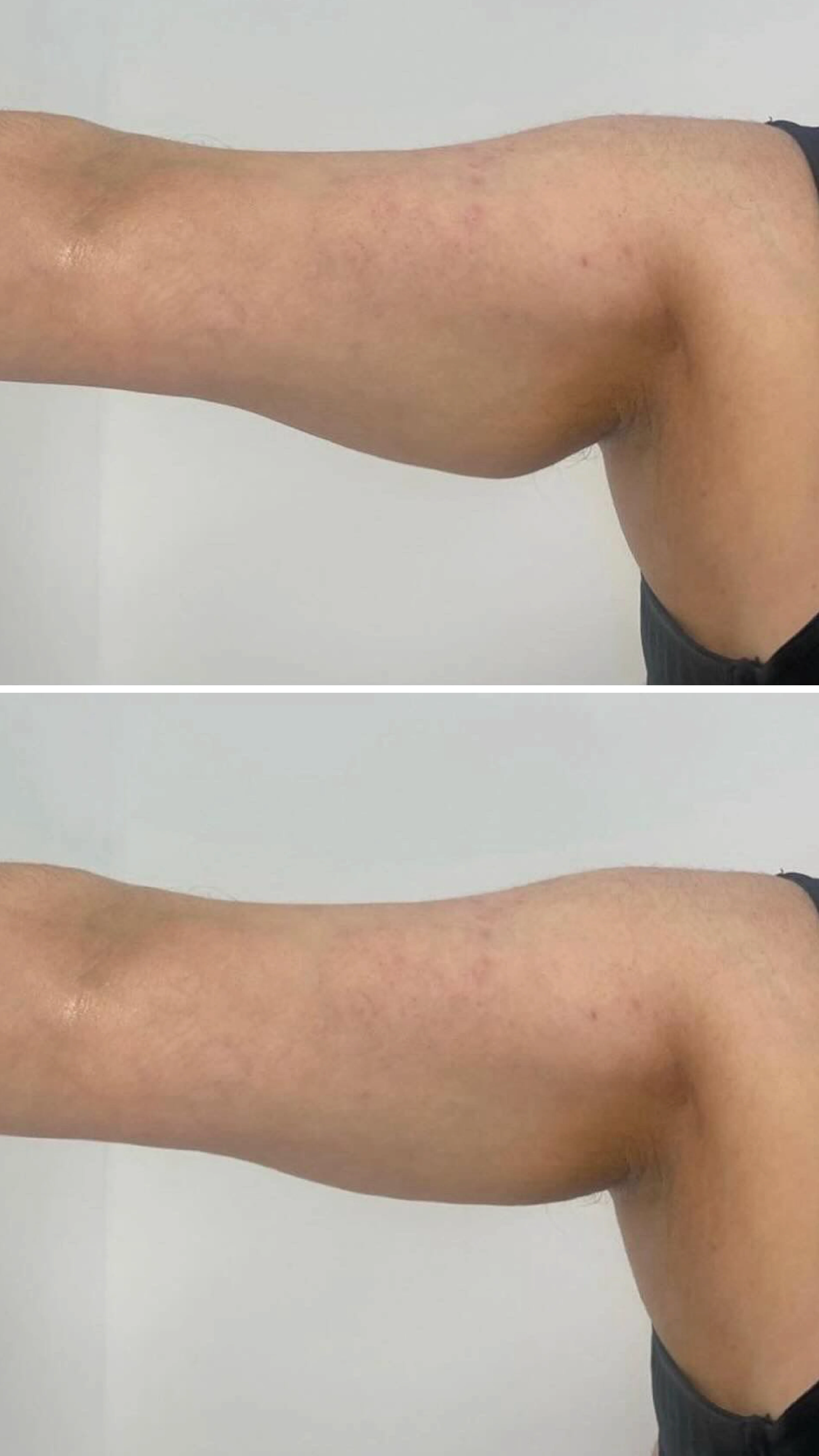 Before After Pictures