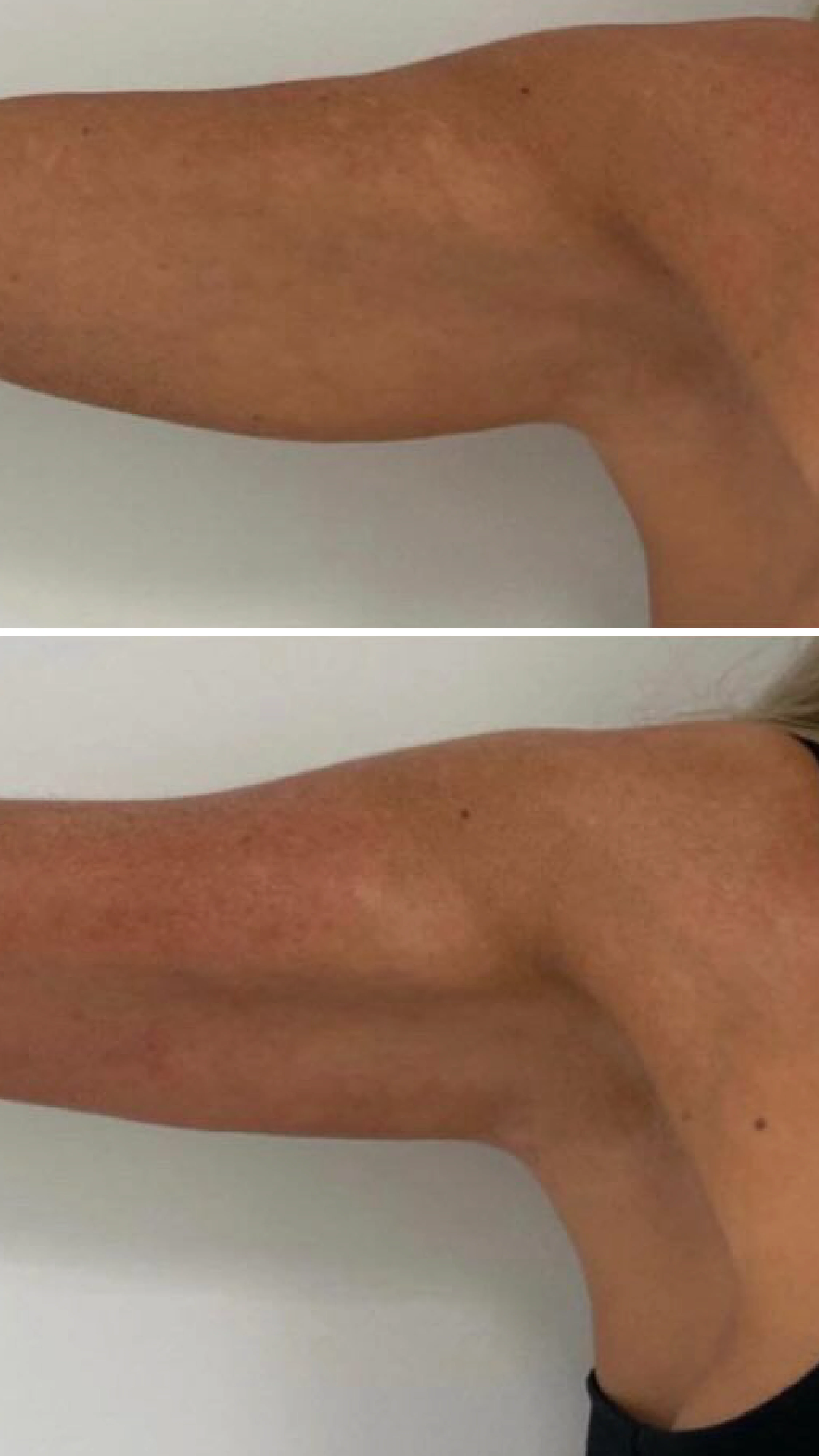 Before After Pictures