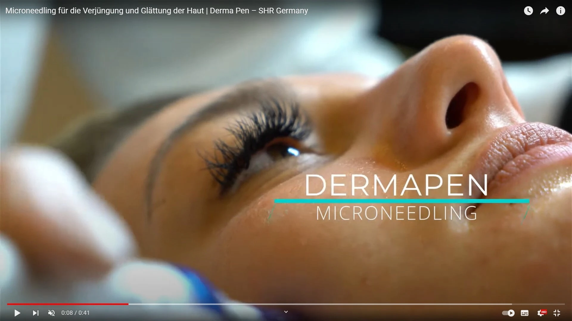 Preview image for the video