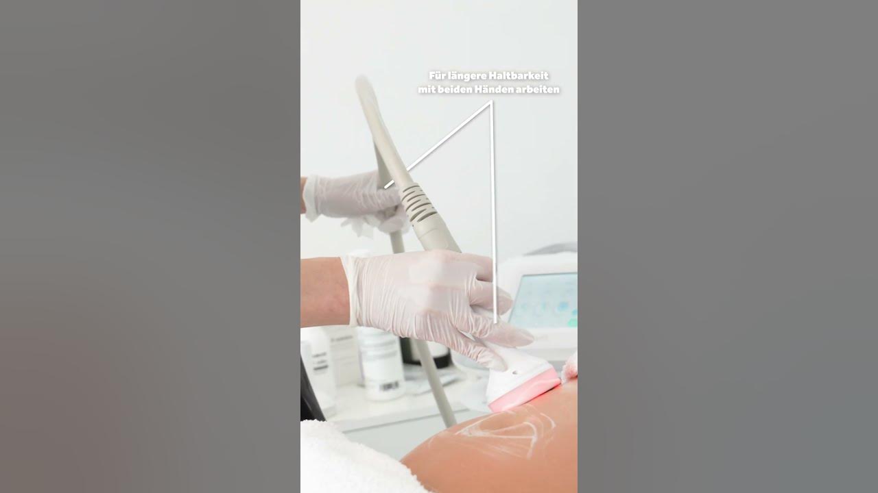 Preview image for the video