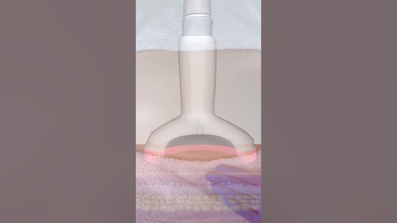 Preview image for the video